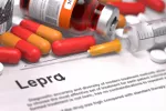 Antibióticos de la lepra Tratamiento de la lepra