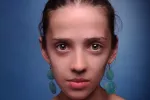 La anorexia afecta a niños cada vez más pequeños La anorexia afecta a niños cada vez más pequeños