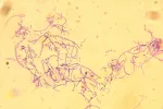 Carbunco o ántrax Bacillus anthracis