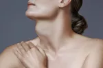 Bocio Mujer con bocio