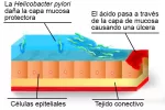 Cuándo se hace una prueba del aliento Cuándo se hace una prueba del aliento
