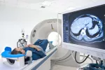 Diagnóstico de la ataxia Diagnóstico de imagen de la ataxia