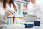 Diagnóstico de la mononucleosis infecciosa Realización del diagnóstico de la mononucleosis infecciosa