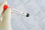 Diagnóstico de la tricomoniasis Detección de la tricomoniasis
