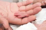 Disminuye la mortalidad de los bebés muy prematuros Un adulto sostiene la manita de un bebé prematuro