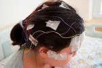 Diagnóstico de la epilepsia Diagnóstico de la epilepsia con EEG