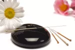 Agujas de acupuntura Indicaciones de la acupuntura
