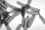 Un brote de legionella causa ya tres muertos en Madrid legionella vista en el microscopio