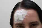 Lesión traumática Descubren cómo se produce una lesión cerebral traumática