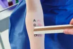 Mantoux Prueba de mantoux