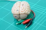 Neuroestimulación contra la depresión Cerebro humano