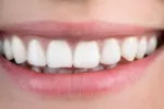 Ortodoncia invisible La ortodoncia invisible es una opción más cómoda, higiénica y estética que la té