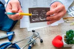 Pericarditis Qué es la pericarditis