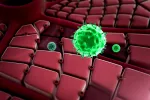 Peritonitis bacteriana secundaria