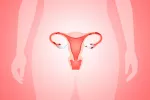 Relacionan la endometriosis con las dioxinas