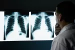 Resultados de la urografía Doctor analizando las radiografías de un paciente