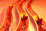 Tipos de hipercolesterolemia