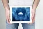 Urografía Persona sosteniendo una radiogafía de su abdomen