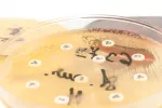 El tratamiento de la mastitis mejoraría con un antibiograma El tratamiento de la mastitis mejoraría con un antibiograma