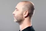 Asocian calvicie y canas prematuras con mayor riesgo cardiovascular Hombre con canas prematuras y calvicie