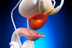 Crean nanomedicina que mejora el tratamiento del cáncer de próstata Crean nanomedicina que mejora el tratamiento del cáncer de próstata