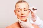 La cirugía estética facial, mejor después del verano La cirugía estética facial, mejor después del verano