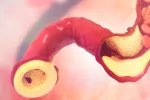 Tener alto el HDL no siempre protege el corazón de las mujeres mayores Ilustración 3D colesterol