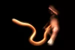 Operan a un bebé durante el parto, antes de cortar el cordón umbilical Bebé unido al cordón umbilical