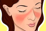 Desarrollan biosensores para detectar el lupus en menos de una hora Lupus