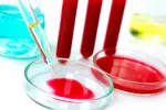 Avances en el diagnóstico de cáncer de la sangre Diagnóstico de cáncer de la sangre