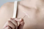DIU anticonceptivo El DIU es más eficaz que la píldora del día después