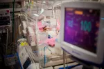Los bebés prematuros sufren dolor sin recibir tratamiento Bebé prematuro ingresado en una unidad de cuidados intensivos neonatales