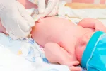 La EMA apoya un gel que previene la onfalitis La EMA apoya un gel que previene la onfalitis