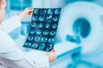Las imágenes por resonancia magnética podrían predecir la demencia Imágenes de una resonancia magnética