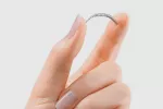 Método anticonceptivo permanente essure