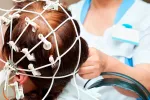 Tratan la anorexia grave con estimulación cerebral Estimulación cerebral