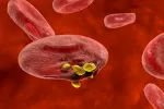 Desarrollan un fármaco que frena el progreso del cáncer de vejiga Glóbulo rojo infectado con parásitos