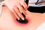 La hipertermia resulta eficaz en el tratamiento del cáncer La hipertermia resulta eficaz en el tratamiento del cáncer