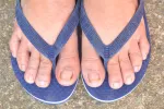 Infecciones en los pies Pies con chanclas de piscina