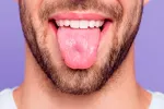 El cáncer de páncreas se podría detectar en la microbiota de la lengua Lengua