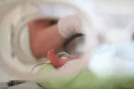 Mejora el pronóstico de los bebés muy prematuros
