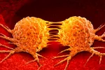El fármaco metarrestina evita la metástasis en varios tipos de cáncer Metástasis en el cáncer