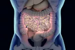 El microbioma intestinal, implicado en la esclerosis múltiple El microbioma intestinal, implicado en la esclerosis múltiple