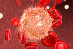 Posible nueva terapia contra la leucemia mieloide aguda leucemia mieloide aguda