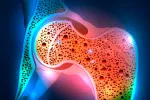 Un nuevo fármaco detiene la progresión del cáncer de ovario Un nuevo fármaco detiene la progresión del cáncer de ovario