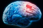 Un nuevo implante cerebral podría mejorar el tratamiento del párkinson Implante cerebral