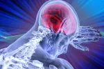 Desarrollan una terapia más eficaz para tratar el ictus en diabéticos Desarrollan una terapia más eficaz para tratar el ictus en diabéticos