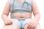 Niño obeso