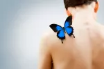 Afectados por 'piel de mariposa' piden ayuda para el tratamiento Piel de mariposa