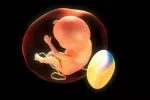 Anomalías Placenta Autismo Las anomalías en la placenta predicen el riesgo de autismo